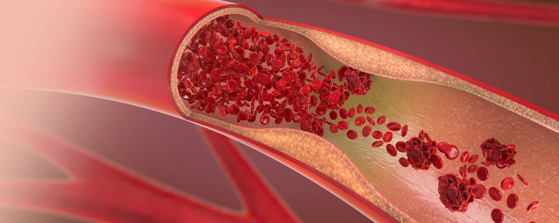Il ruolo del Ginkgo biloba nel supporto della microcircolazione